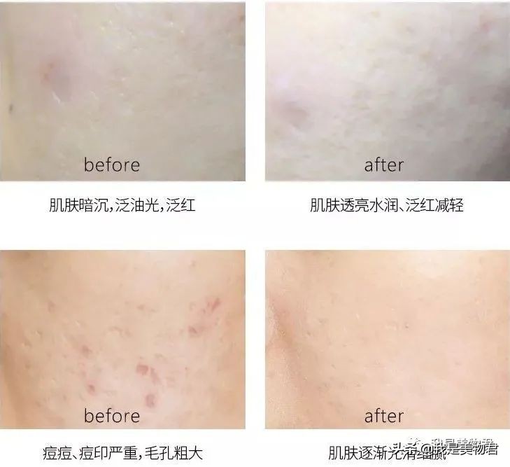 老虎面膜叫什么,老虎面膜是含有激素的面膜吗