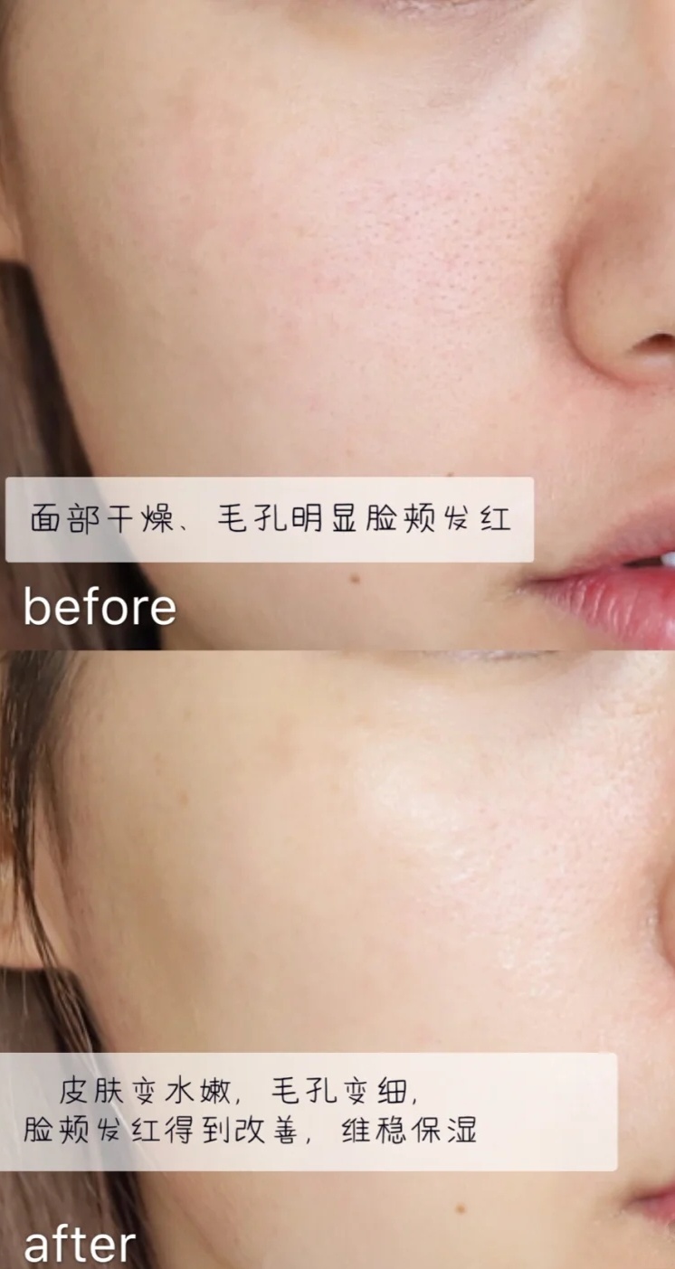 郑爽晒的“宝藏”面膜，补水保湿还美白，张歆艺：平价又好用