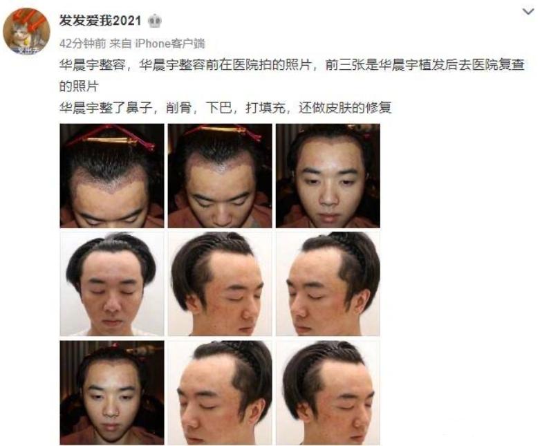 网友“发发爱我2021”放锤华晨宇出轨、整容，还秃头！你怎么看？