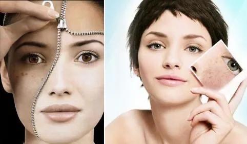 祛斑难？试试这样做！