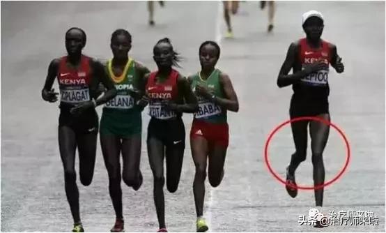 怎么让腿型改正,怎样使腿型变直