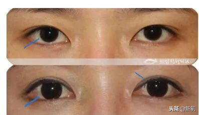 辛芷蕾是苦相女生吗,辛芷蕾气质怎么养成