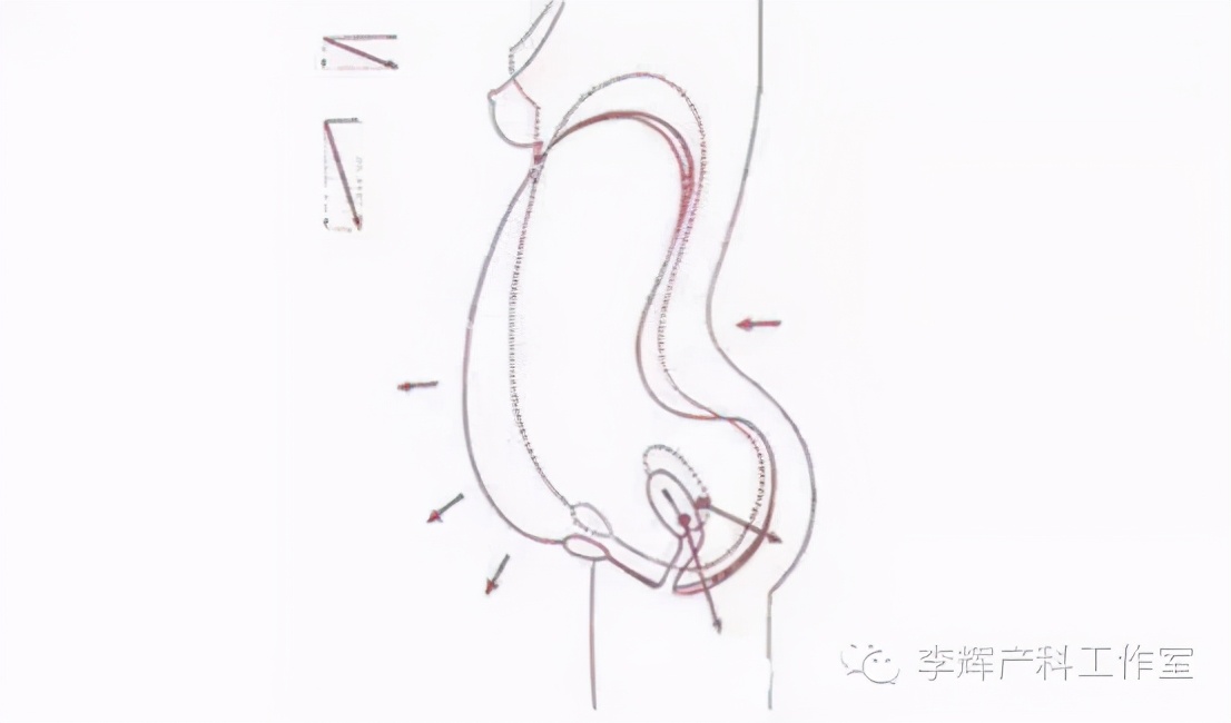 产后42天做盆底康复检查有必要吗,产后42天盆底康复做哪些检查