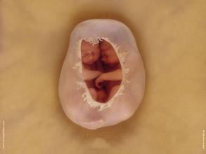 剖腹产孕37周和39周区别,为什么剖腹产建议38-39周生