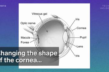 手术的时候医生对你做了什么,手术时切了一片肺叶