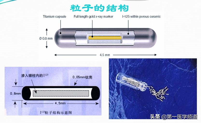 「医影传声」上海交通大学医学院附属瑞金医院卢湾分院放射科主任