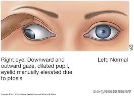 眼球人体解剖学讲解,眼睛解剖讲解