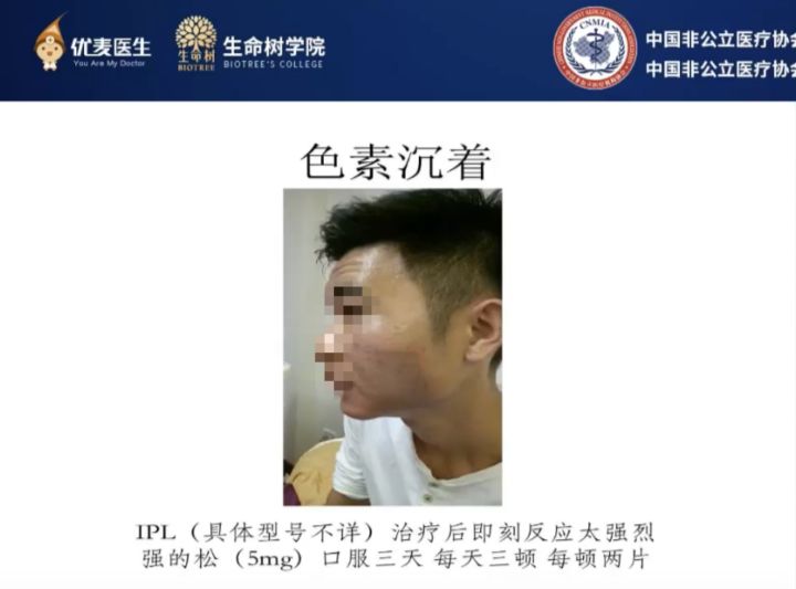 哪种医美项目祛痘印最有效,最有效的医美抗衰项目