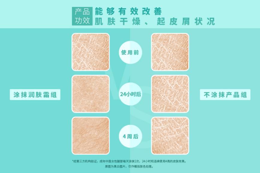 头上干性湿疹怎么护理,被湿疹折磨的宝宝