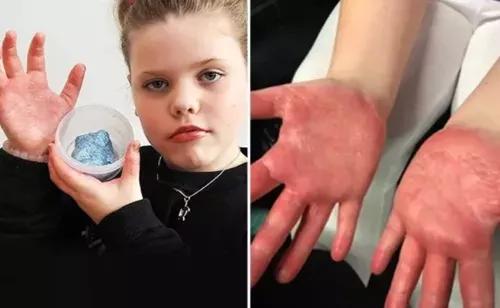 眼睛险失明,毒素超标,听力受损…这些网红夺命儿童玩具别再买