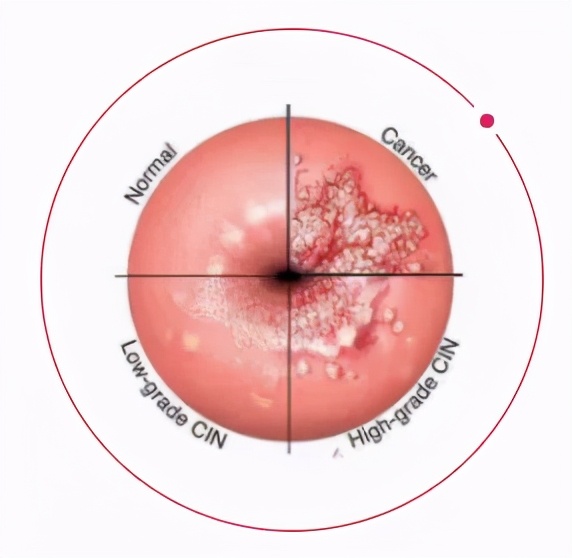 人流手术前需要做哪些检查,人流手术需要做哪些术前检查
