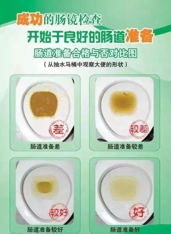 肠镜内镜检查全过程,带你了解胃肠镜全过程