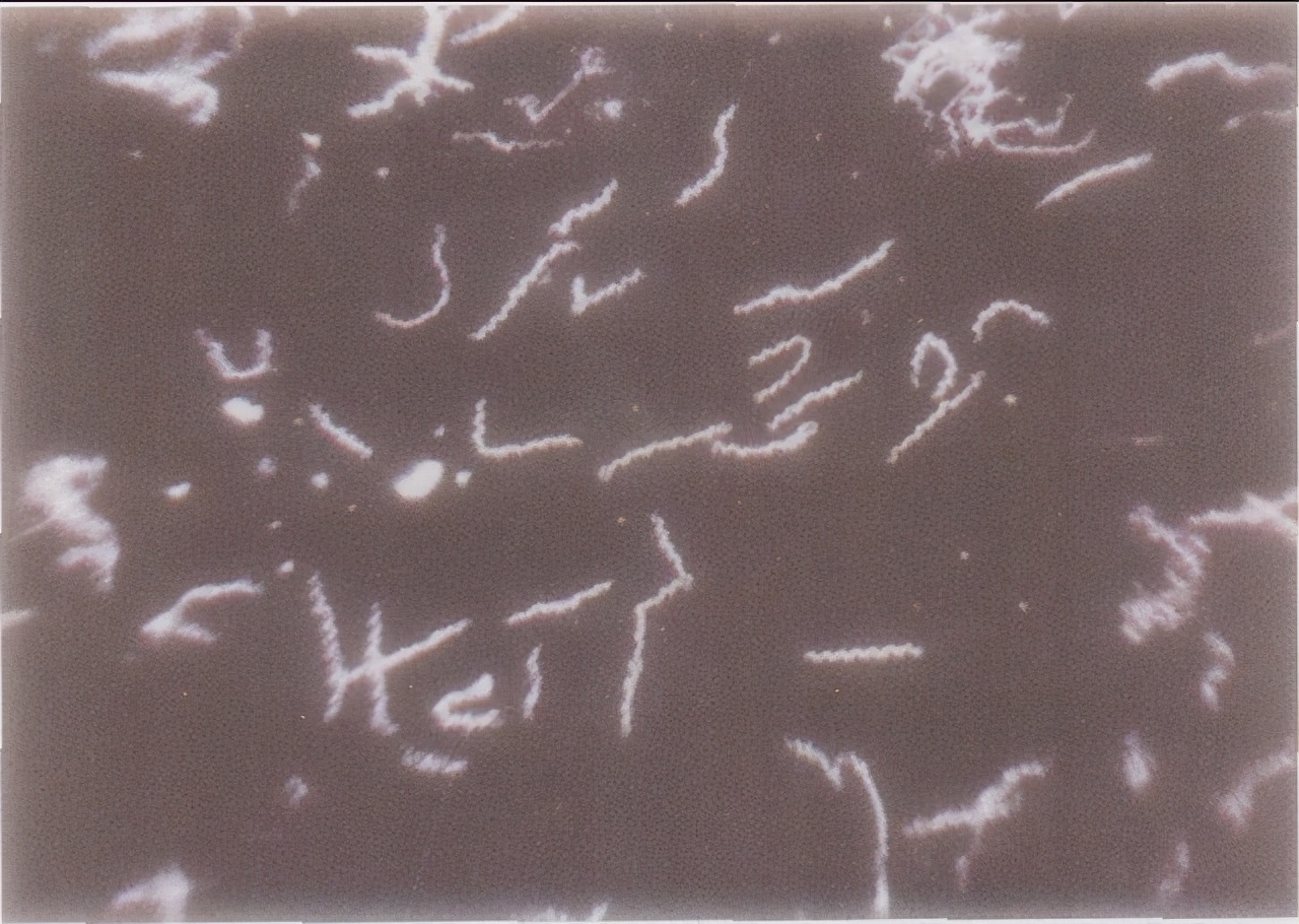 梅毒历史解说视频,历史上的梅毒怎么消灭的