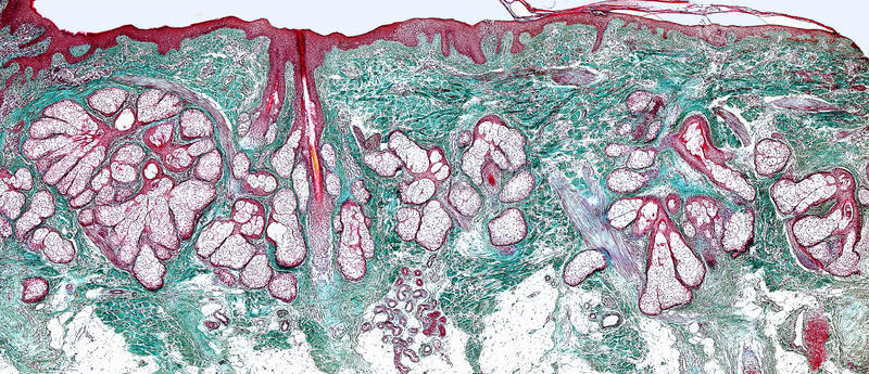 头皮爱出油教你几个小方法,男士头皮出油用什么洗发水控油