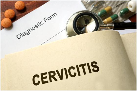 宫颈重度炎症对怀孕有影响吗,宫颈重度炎症如何治疗效果最好