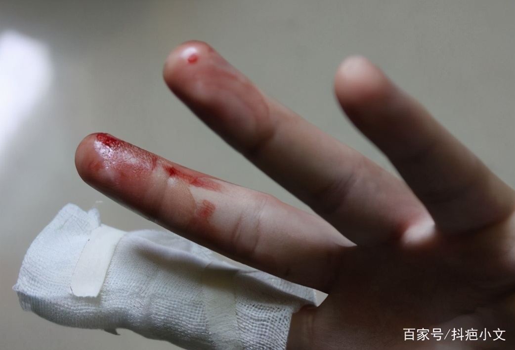 孩子不小心受伤了怎样问老师,孩子不小心摔伤怎么处理