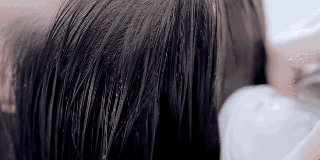 头皮干燥头屑多解决小妙招,秋冬头皮干燥有头屑怎么治疗