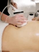 额头长闭口毛孔粗大爆痘怎么办,皮肤爆痘起闭口怎么回事