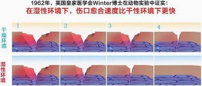 美食→生物材料|小龙虾→伤口敷料