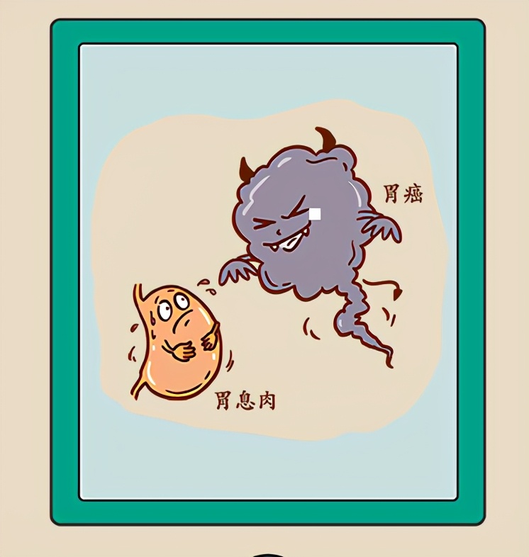 得了胃息肉会得胃癌吗,胃息肉会变成胃癌么