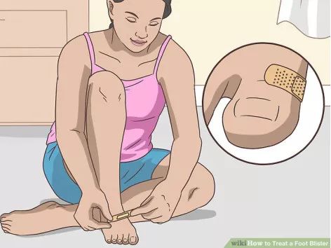 如何预防与处理比跑步膝痛还烦人的水泡？