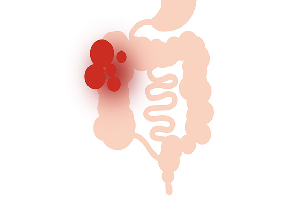 频繁放屁代表肝脏不好吗,经常放屁肚子胀气是肝的惨叫信号