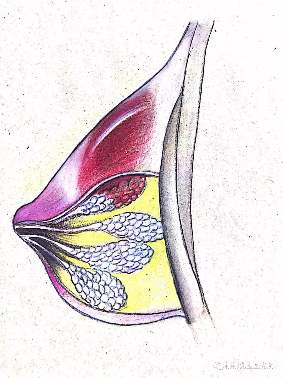 良性乳腺肿瘤要切除吗,乳腺良性病变可能性大
