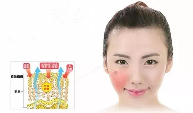 医用面膜和普通面膜有什么区别?医用面膜知识大科普!