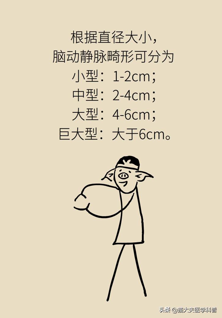 脑血管畸形在哪些部位比较严重,先天性脑血管畸形可以治愈吗