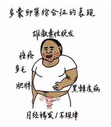 生活方式干预门诊是什么门诊,pcos患者首选方案