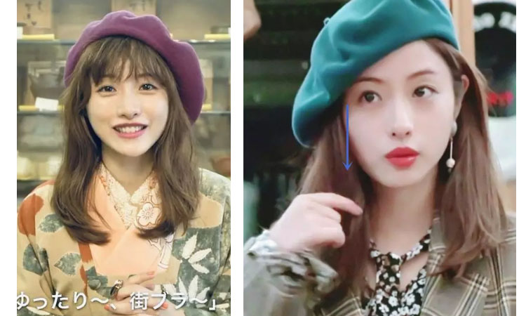 中国人扁头是怎么回事,有什么能拯救扁头发型