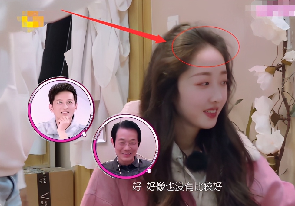 蒋梦婕秃头,蒋梦婕综艺看头发