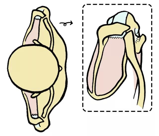 肩伤如何练肩,骨科专家教你肩袖康复训练