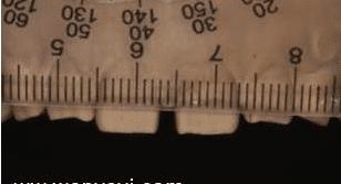 门牙裂了一条缝,门牙有缝的女人