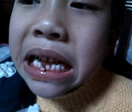 6岁小朋友换牙门牙太大,换牙小知识大全