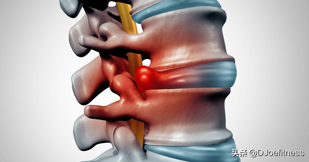 深蹲训练时腰疼的原因和改善方案,深蹲训练伤腰吗