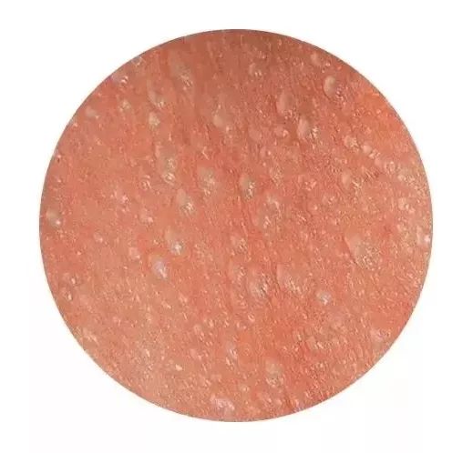 夏天宝宝长痱子怎么办,宝宝夏季长痱子怎么办