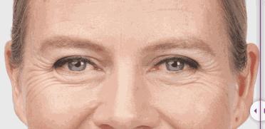 马伊琍资生堂玻尿酸微针眼膜,资生堂微针眼贴