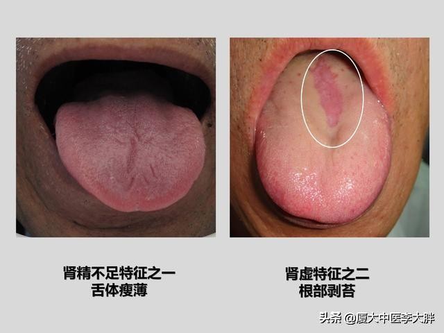 激情过后总是尿频、腰酸,这到底是不是肾虚,该怎么调理?