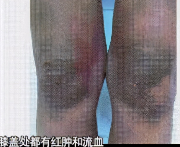 疯狂英语李阳事件完整版,疯狂英语李阳生平