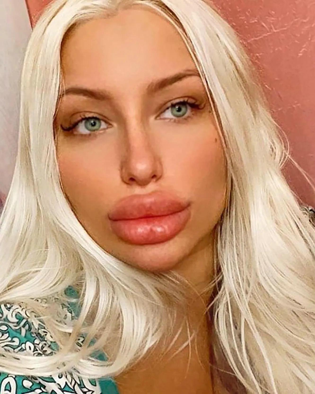 人造女人漂亮吗,人造嘟嘟嘴唇