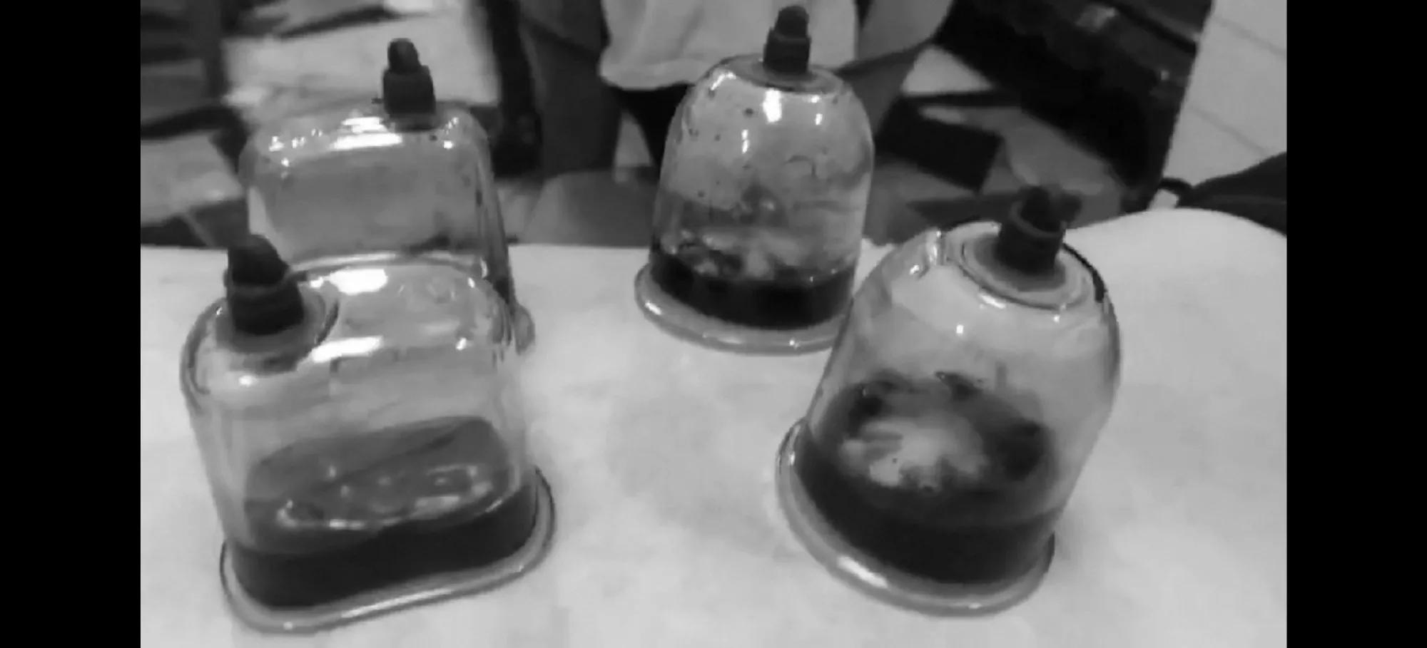 净血疗法的正确方法,净血疗法301