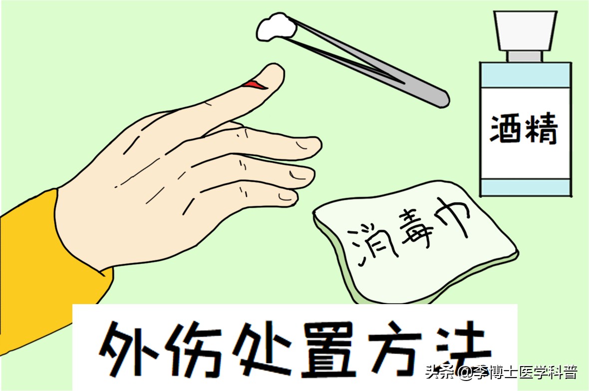 手部外伤急救,手部外伤家庭急救手抄报