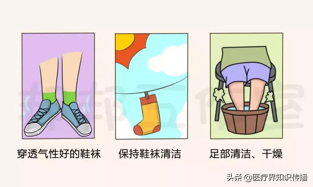 脚气引起的脚面溃烂肿胀怎么治愈,脚气用什么药膏可以彻底治愈