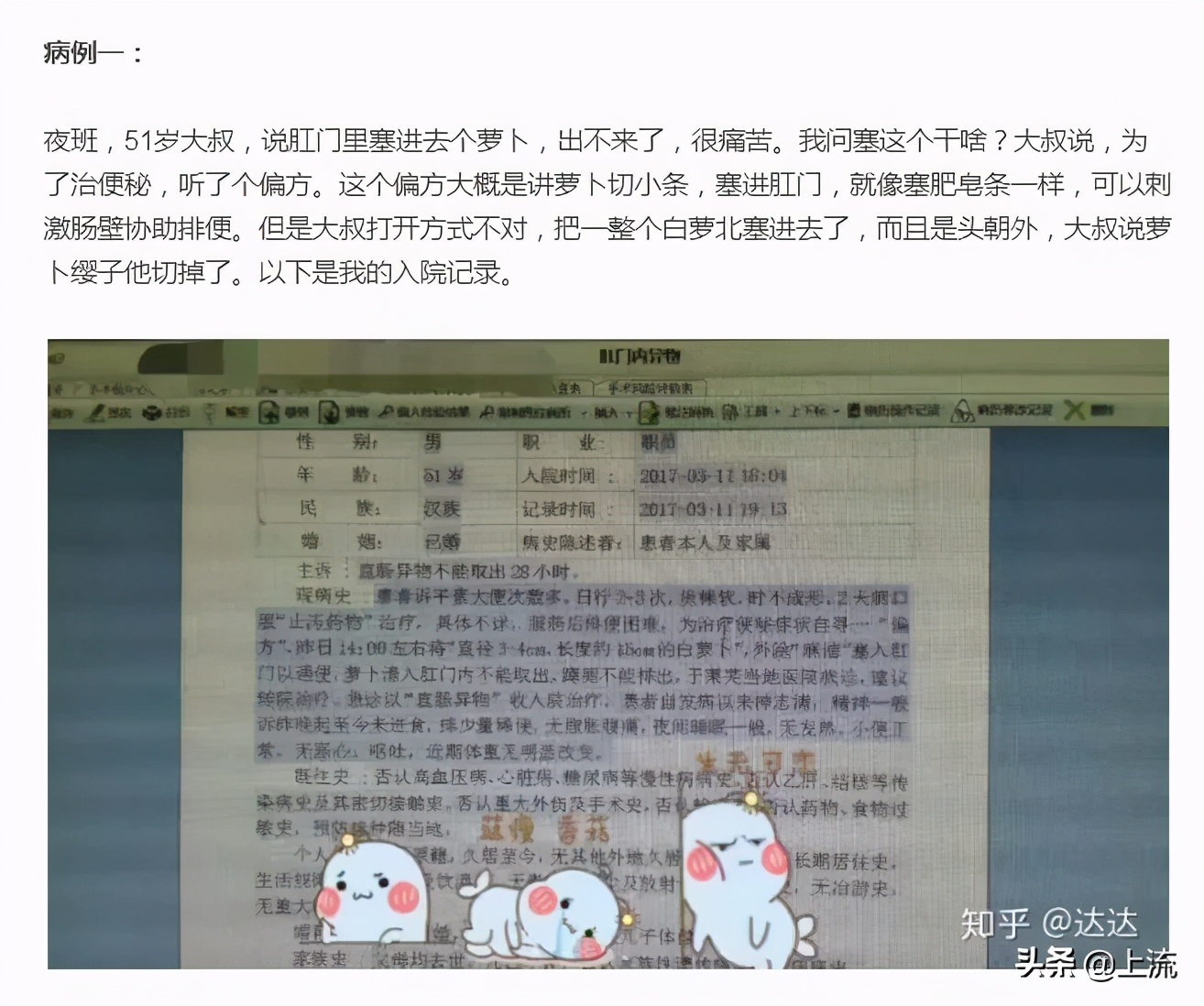 肛肠科医生的手指为什么这么粗,肛肠科医生用手指做检查