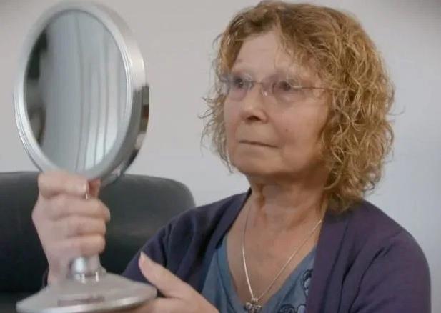 英国女子被假医生注射肉毒杆菌,脸部肿胀像外星人,差点丧命