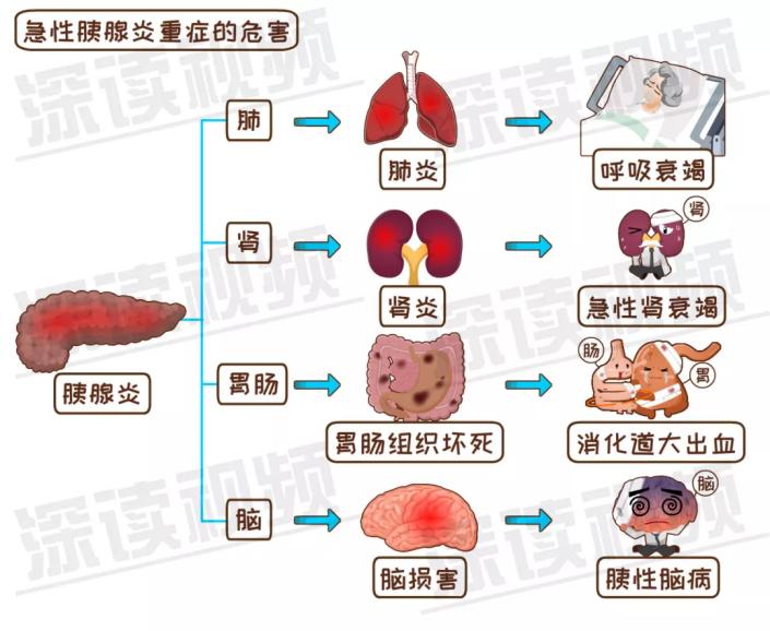 大吃大喝容易引发急性胰腺炎,月子期间胰腺炎是怎么引起的