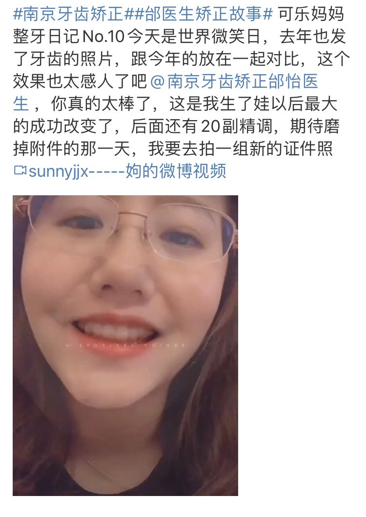 正畸医生邰怡的作品,南京牙齿矫正邰医生