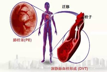 70岁老人不活动就感觉呼吸费劲,老人不咳但呼吸困难是什么原因