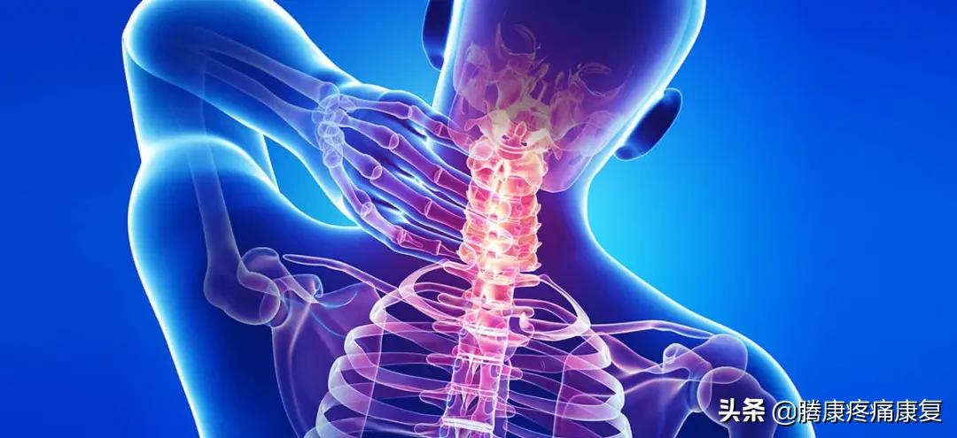 颈丛神经卡压症推拿手法,颈神经卡压的症状是什么